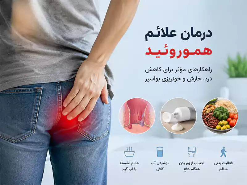 درمان علائم هموروئید