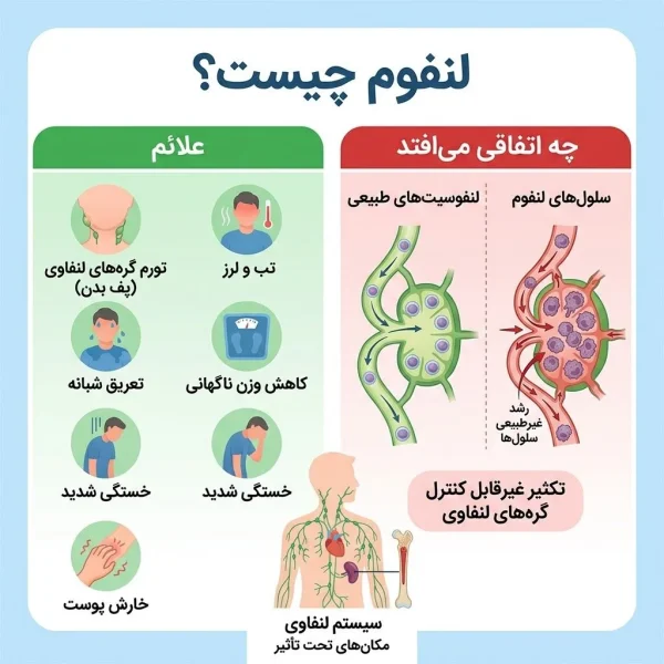 لنفوم